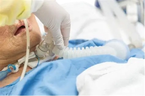 医疗呼吸机上专用阀